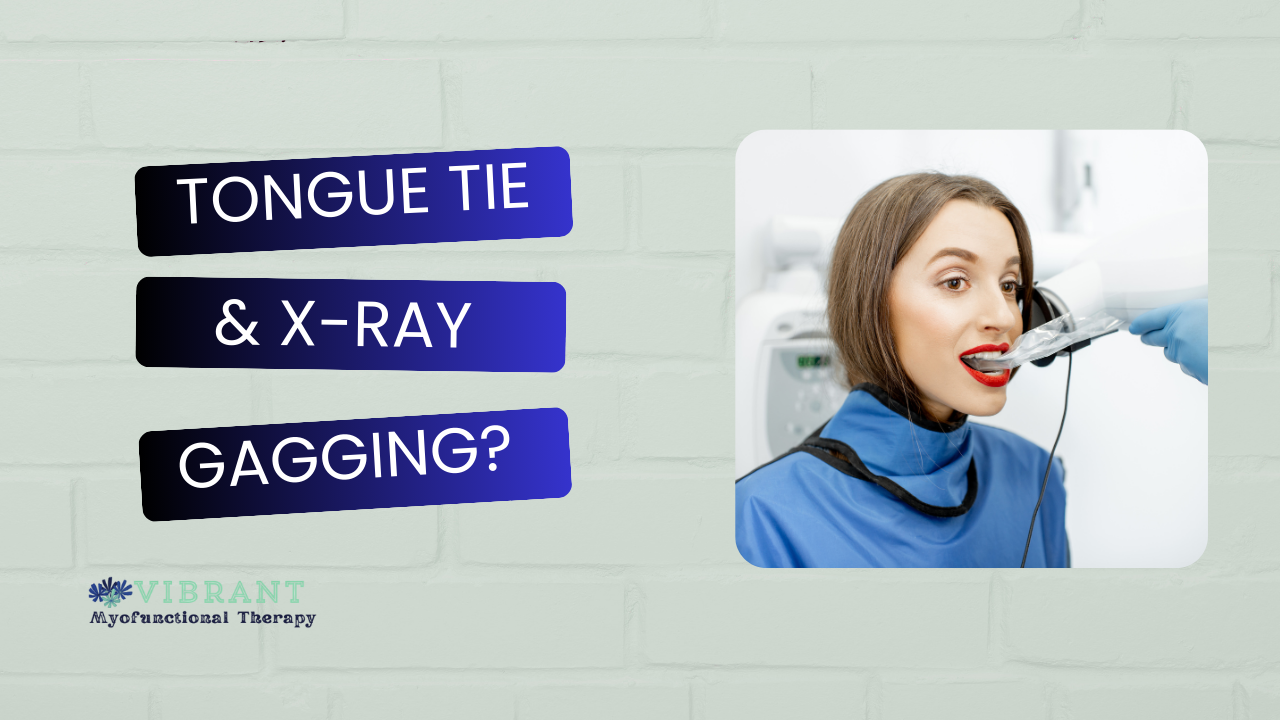 Is Your Tongue Tied? What Gagging During Dental X-Rays Might Be Telling You