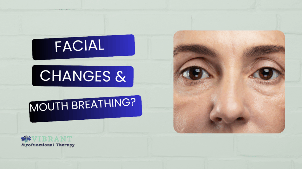 Blog post facial changes due to mouth breathing